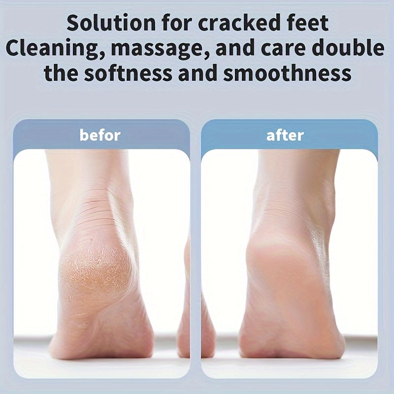 Mpow Electric foot callus remover White